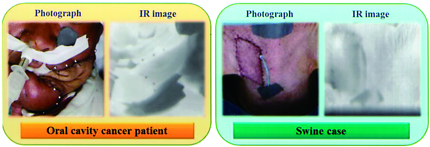 Infrared Imaging Core Photo 05