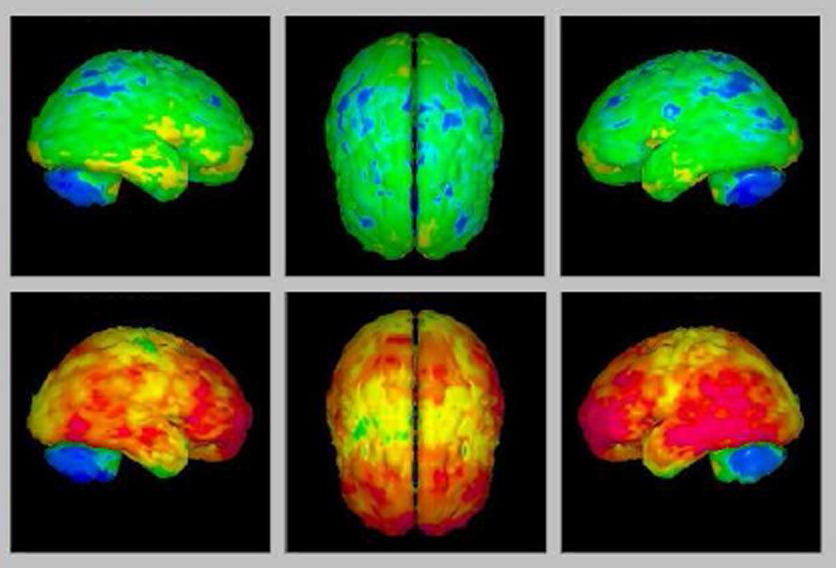 Positron Emission Tomography Core Photo 03