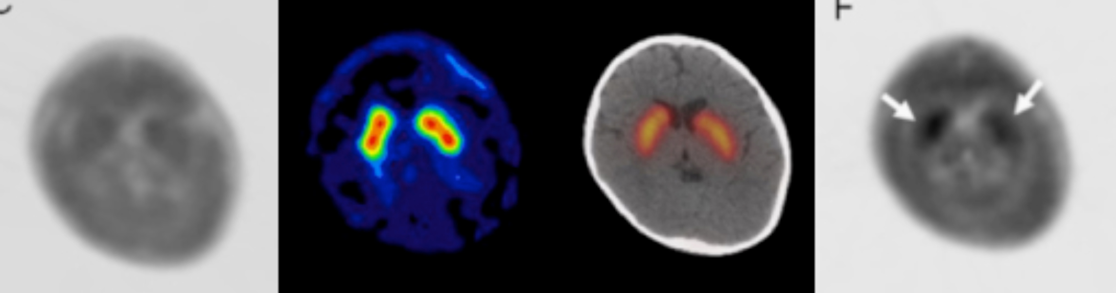 Positron Emission Tomography Core Photo 04